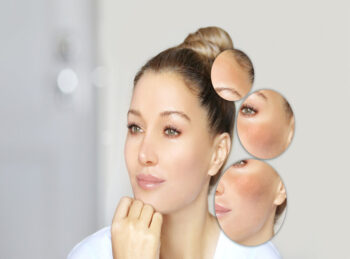 Intimate Brightening